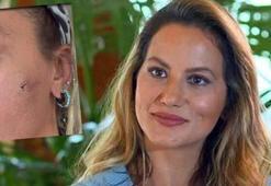 Yıldız Asyalı'dan şoke eden paylaşım! 'Kocam tarafından darp edildim'