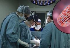 Kuduzdan ölen kişinin organı nakledildi, bir ölüm daha geldi! Doktorlar şaşkın