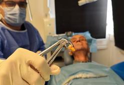 83 yaşında 20'lik dişi çıktı: Herkesin başına gelebilir