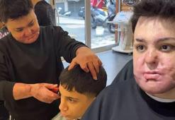 Hayatı birkaç saniye içinde kabusa döndü!15 yaşında 8 ayda 65 ameliyat geçirdi