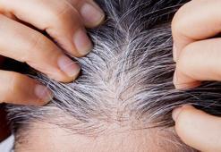 Saçlar neden beyazlar, geri döndürmek mümkün mü? Bilim insanları gerçeği açıkladı