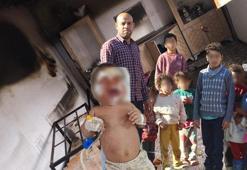 14 kişilik ailenin evinde esrarengiz yangınlar! 2 aylık bebekleri yanarak yaralandı: 'Hepimiz aynı odada kalıyoruz'