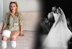 Avukat öldü, genç kadın iki bacağını kaybetti! TIR faciasında şoför ilk kez konuştu: 'Fren arızası'