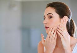 'Makyaj, hormonlar ve beslenme yetişkinlerde akne alarmı veriyor'