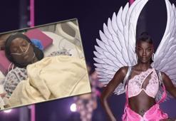 Victoria's Secret modelinin sağlık mücadelesi! 'Akciğerlerimi yok ediyor'