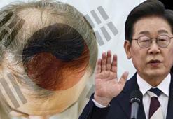 Güney Kore lideri kelliğe savaş açtı! 'Ölüm-kalım meselesi' mi yoksa 'oy toplama' hamlesi mi?