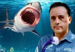 Köpek balığı yüzünü ısırdı, hayatta kaldı! 'İsteseydi öldürebilirdi, hayatımı bağışladı'