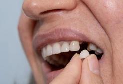 Diş kaybı yalnızca estetik bir sorun değilmiş! Etkisi bambaşka