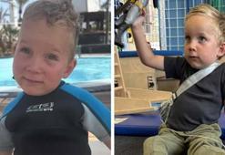 İki yaşını göremez dediler, aldığı terapi hayatını değiştirdi! 'Beklenenin çok üstünde'