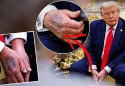 Trump elindeki morlukların sebebini açıkladı! Çeşitli söylentiler vardı