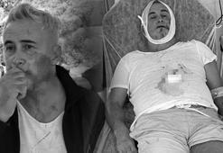 Çenesi kırıldı, dehşeti anlattı: Saldırıyı yapan kişi eski bir milli futbolcu