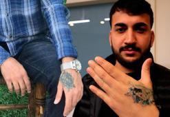 Dövme sildirmek isterken felaketi yaşadı! 'Eczaneden ağrı kesici al'