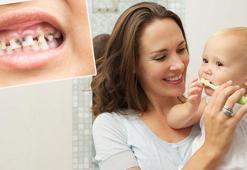 Bebeklerde sessiz tehlike: Biberon çürüğü! En sık ön dişlerde görülüyor