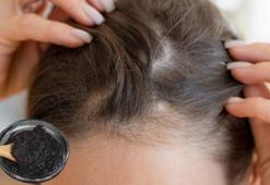 Stres yüzünden kellik yaşadı! Formülü varmış, saç köklerini coşturan şampuan