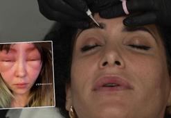 Kaşlarını bu teknikle boyattı, yüzü davul gibi şişti! 'Kendimi tanıyamadım'