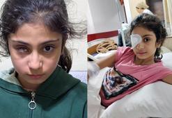 8 yaşındaki Şeyma’yı kör eden gözlük! Aile şaşkına döndü: ‘Kızımın geleceği gitti’