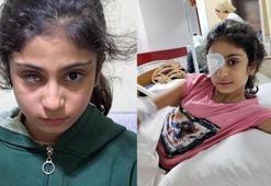 8 yaşındaki Şeyma’yı kör eden gözlük! Aile şaşkına döndü: ‘Kızımın geleceği gitti’