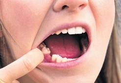 Yaşam süresi dişlerde gizli
