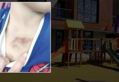 İBB kreşinde darp ve istismar iddiası! İstanbul Valiliği soruşturma başlattı