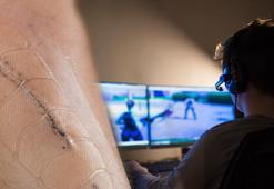 Diz ameliyatından çıktı ana dilini unuttu: Kendini ABD'de sandı! Peki sebebi oyunlar mı?