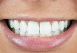 Dişleri bembeyaz yapıyor! Meğer püf noktası buymuş