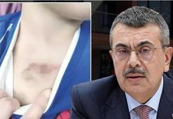 İBB kreşinde istismar ve darp iddiası! Bakan Tekin: Haklı olduğumuzu ortaya koydu