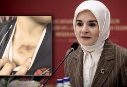 İBB'ye ait kreşte darp ve istismar iddiası! Bakan Göktaş: Maalesef farklı ihbarlar geliyor