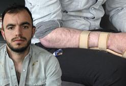 Başına metal saplandı, hayatı karardı! 18 milyon TL’lik rekor tazminat