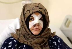 Eşinin kaldırım taşı ile dövdüğü Nazlı: Ayaklarım üzerinde dursaydım o adama dönmezdim