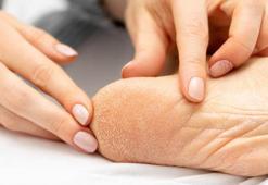 Pedikür salonlarını unutun: Evde topuk çatlaklarını bebek cildi gibi yapan doğal kür