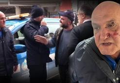 Kaldırım parkı kavgası! Zabıta memuruna yumruklu saldırı: Hastanelik oldu