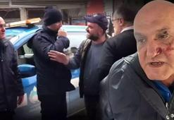 Kaldırım parkı kavgası! Zabıta memuruna yumruklu saldırı: Hastanelik oldu