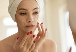 3 ayda cam gibi cilde kavuşun! Asya kadınlarının etkili karışımı