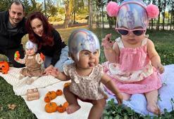 Doğumda öğrendikleri teşhis hayatlarını değiştirdi! ‘Doktorun ağzından duymak dünyamı yıktı’