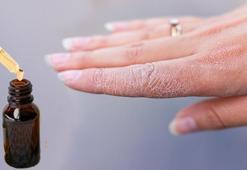 Eldeki çatlakları bir gecede pamuk gibi yapıyor! Cilt üzerinde bariyer etkisi