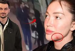 Fenomen Danla Biliç’i darbeden eski sevgilinin cezası belli oldu
