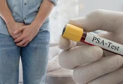 Sinsice ilerliyor, gençlerde de yaygınlaşıyor! PSA testini ihmal etmeyin