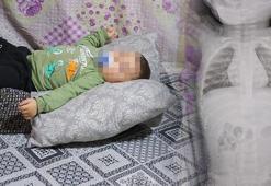 Bebeğin içinde ilerliyordu! 1 yıl boyunca ağladı: Tomografide korkunç gerçek
