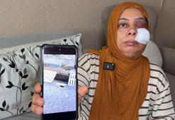 Elektrikli bisikletiyle rögara düştü! Dişleri kırıldı, yüzüne 14 dikiş atıldı