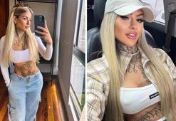 Estetik ameliyat sonrası hayatını kaybetti! Sosyal medya fenomeninin acı sonu