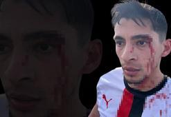 Amatör futbol maçında kavga çıktı, 3 futbolcu hastanelik oldu