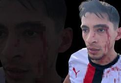 Amatör futbol maçında kavga çıktı, 3 futbolcu hastanelik oldu