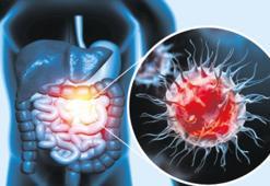 50 yaş altı kolon kanseri alarmı!