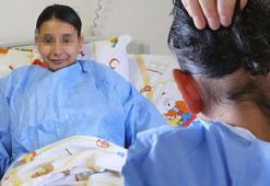 Her şey 6 şubat depremi ile başladı! 14 yaşındaki kızın midesinden 3 kilo saç yumağı çıktı