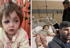 Yalova’da 14 aylık bebeği hastanelik ettiler! İddiaların odağındaki komşu konuştu