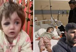 Yalova’da 14 aylık bebeği hastanelik ettiler! İddiaların odağındaki komşu konuştu