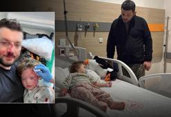 İçişleri Bakanlığı, Yalova’da baba ve 14 aylık bebeğine darp olayıyla ilgili harekete geçti