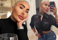 Kim Kardashian'a benzemek için 130 bin sterlinlik estetikleriyle gündem olmuştu! ‘Dudak Kralı’nın feci ölümü