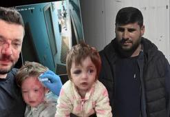 Yalova’daki 14 yaşındaki bebeğin de yaralandığı komşu kavgasının güvenlik kamerası görüntüleri ortaya çıktı