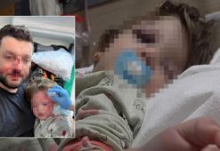 Yalova'da İkra bebek ve babasına saldıran komşunun ifadesi kan dondurdu